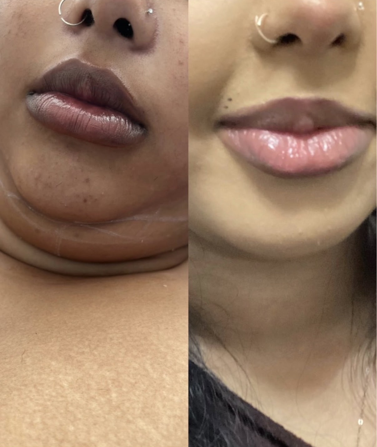 Lemon Bottle client before and after photographs
